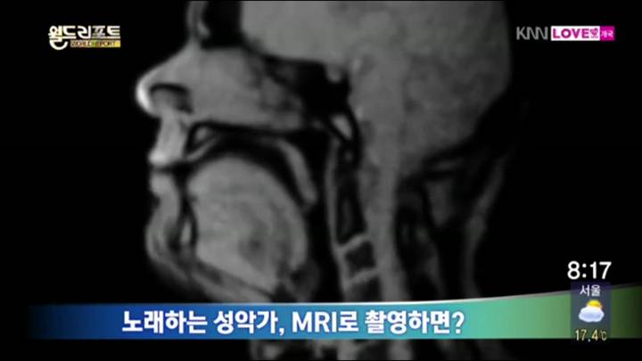 노래하는 성악가 MRI로 촬영했을때 어떤 모습인가?
