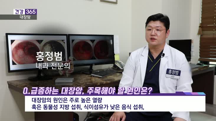 [건강365]-한국인 대장암, 10년 뒤 2배?